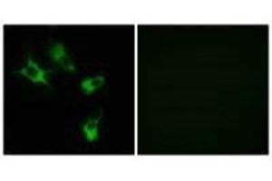 Immunofluorescence analysis of COS-7 cells, using MAST4 antibody. (MAST4 Antikörper)
