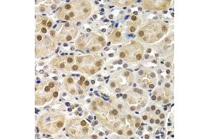 Immunohistochemistry of paraffin-embedded mouse kidney using ID3 antibody (ABIN5973111) at dilution of 1/200 (40x lens). (ID3 Antikörper)