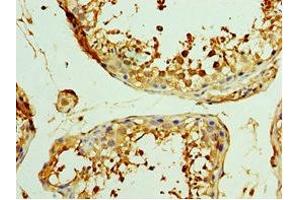Immunohistochemistry of paraffin-embedded human testis tissue using ABIN7175850 at dilution of 1:100