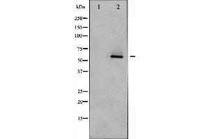 Western blot analysis of Akt2 expression in TNF-α treated A2780 whole cell lysates,The lane on the left is treated with the antigen-specific peptide. (AKT2 Antikörper  (C-Term))