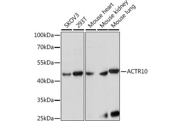 ACTR10 Antikörper  (AA 218-417)