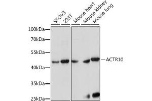 Western blot analysis of extracts of various cell lines, using  antibody (ABIN7265390) at 1:1000 dilution. (ACTR10 Antikörper  (AA 218-417))