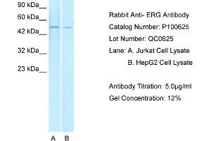 WB Suggested Anti-ERG  Antibody Titration: 1. (ERG Antikörper  (Middle Region))