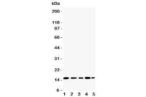 Western blot testing of TIA-1 antibody and Lane 1:  Jurkat (TIA1 Antikörper  (N-Term))