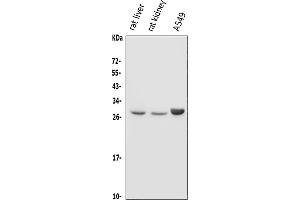 Western blot analysis of DIO1 using anti-DIO1 antibody (ABIN7599988).