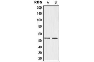 Western blot analysis of p53 (pS15) expression in HeLa UV-treated (A), PC12 (B) whole cell lysates. (p53 Antikörper  (N-Term, pSer15))
