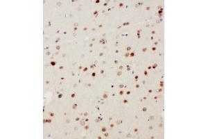 Immunohistochemistry (IHC) image for anti-Mitogen-Activated Protein Kinase Kinase Kinase 3 (MAP3K3) (AA 11-25), (N-Term) antibody (ABIN3044008)