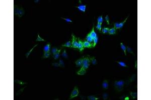 Immunofluorescence staining of HepG2 cells with ABIN7170953 at 1:166, counter-stained with DAPI. (SULT1A3 Antikörper  (AA 1-295))