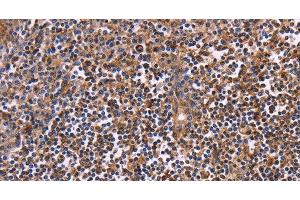 Immunohistochemistry of paraffin-embedded Human tonsil using CLUAP1 Polyclonal Antibody at dilution of 1:50 (CLUAP1 Antikörper)