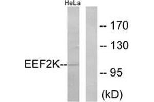 Western blot analysis of extracts from HeLa cells, treated with serum 10% 15', using eEF2K (Ab-366) Antibody. (EEF2K Antikörper  (AA 331-380))
