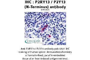 Image no. 1 for anti-Purinergic Receptor P2Y, G-Protein Coupled, 13 (P2RY13) (Extracellular Domain), (N-Term) antibody (ABIN1737760) (Purinergic Receptor P2Y, G-Protein Coupled, 13 (P2RY13) (Extracellular Domain), (N-Term) Antikörper)