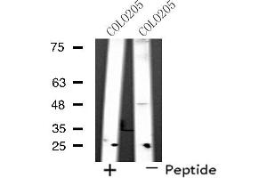 Western blot analysis of extracts from COLO205 cells, using SYT11 antibody.