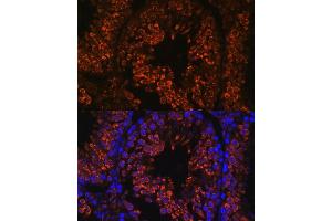 Immunofluorescence analysis of mouse testis using FER1L5 antibody (ABIN7267166) at dilution of 1:100. (FER1L5 Antikörper  (AA 1350-1670))