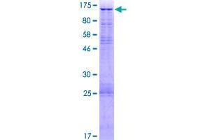 URGCP Protein (AA 1-856) (GST tag)