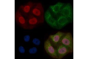 WDR70 Mouse Monoclonal Antibody staining Hela cells by IF/ICC. (WDR70 Antikörper)