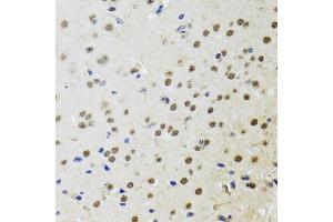 Immunohistochemistry of paraffin-embedded mouse brain using BTK antibody (ABIN5970757) at dilution of 1/100 (40x lens). (BTK Antikörper)