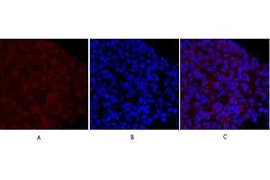 Immunofluorescence analysis of mouse lung tissue. (MEK1/2 Antikörper)