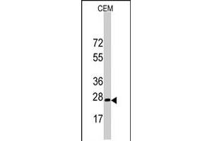 Western blot analysis of BARX1 polyclonal antibody  in CEM cell line lysates (35 ug/lane). (BARX1 Antikörper  (C-Term))