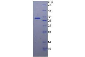 SDS-PAGE analysis of Human Ataxin 1 Protein. (Ataxin 1 Protein (ATXN1))