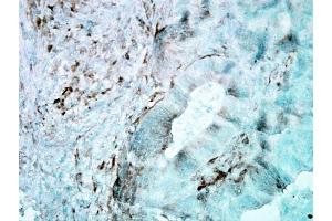 Immunohistochemistry analysis using Mouse Anti-Hsp27 Monoclonal Antibody, Clone 8A7 . (HSP27 Antikörper  (Atto 488))