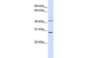 WB Suggested Anti-RPL3 Antibody Titration:  0. (RPL3 Antikörper  (N-Term))