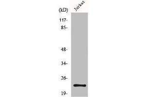 Western Blot analysis of Jurkat cells using MGMT Polyclonal Antibody (MGMT Antikörper  (N-Term))