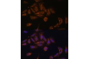 Immunofluorescence (IF) image for anti-Ribosomal Protein L7a (RPL7A) (AA 1-266) antibody (ABIN6147151)