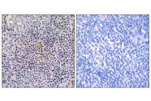 Immunohistochemistry (IHC) image for anti-X-Ray Repair Complementing Defective Repair in Chinese Hamster Cells 3 (XRCC3) (Internal Region) antibody (ABIN1850510) (XRCC3 Antikörper  (Internal Region))