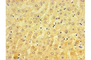 Immunohistochemistry of paraffin-embedded human liver tissue using ABIN7148440 at dilution of 1:100 (CRX Antikörper  (AA 120-285))