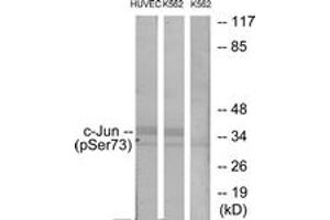 Western blot analysis of extracts from HuvEc cells treated with TNF 20ng/ml 5' and K562 cells treated with TNF 20ng/ml 5', using c-Jun (Phospho-Ser73) Antibody. (C-JUN Antikörper  (AA 40-89))