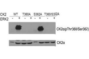Western blot of CK2α(Phospho- Thr360/Ser362) antibody and CK2α antibody in vitro kinase assay. (CSNK2A1/CK II alpha Antikörper  (pSer362, pThr360))