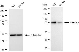 Western blotting analysis using PRKCSH antibody (ABIN7799984). (Rekombinanter PRKCSH Antikörper)
