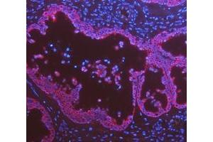 IF analysis of Cytokeratin 8/KRT8 using anti-Cytokeratin 8/KRT8 antibody (ABIN5518853). (KRT8 Antikörper  (AA 107-325))