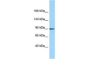 Host: Rabbit Target Name: CRNKL1 Sample Type: Jurkat Whole Cell lysates Antibody Dilution: 1. (CRNKL1 Antikörper  (C-Term))