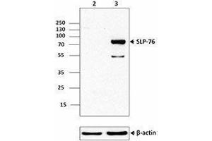 Western Blotting (WB) image for anti-Lymphocyte Cytosolic Protein 2 (SH2 Domain Containing Leukocyte Protein of 76kDa) (LCP2) (AA 216-434) antibody (ABIN2666114)