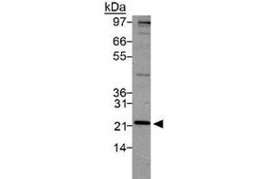 Western blot analysis of PSMD10 in HeLa lysate using with PSMD10 polyclonal antibody . (PSMD10 Antikörper  (AA 100-200))