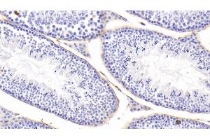 Immunohistochemistry (IHC) image for anti-Microfibrillar Associated Protein 5 (MFAP5) (AA 25-152) antibody (ABIN7442120)