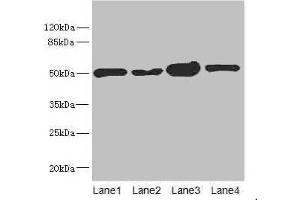 Western blot All lanes: CHN1 antibody at 6. (CHN1 Antikörper  (AA 1-200))