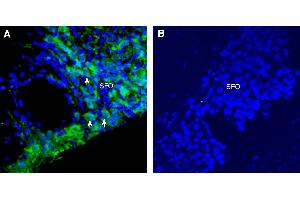 Expression of SCN7A in rat sub-fornical organ (SFO).