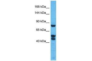 Host:  Rabbit  Target Name:  KDM3B  Sample Type:  Thymus Tumor lysates  Antibody Dilution:  1. (KDM3B Antikörper  (N-Term))
