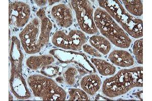 Image no. 3 for anti-Melan A (MLANA) antibody (ABIN1499425) (MLANA Antikörper)