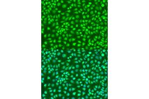 Immunofluorescence analysis of U2OS cells using IKBKB antibody.
