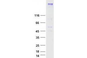 Western Blotting (WB) image for Sphingosine-1-Phosphate Receptor 2 (S1PR2) protein (Myc-DYKDDDDK Tag) (ABIN2719937)