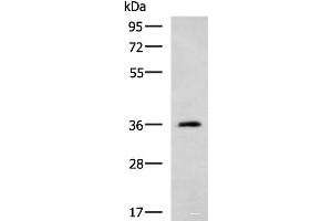Western blot analysis of Human cerebella tissue lysate using ATP1B2 Polyclonal Antibody at dilution of 1:650 (ATP1B2 Antikörper)