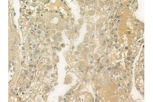 ABIN6257866 and ABIN6274832 at 1/100 staining human normal lung tissue by IHC-P. (ACER3 Antikörper  (Internal Region))