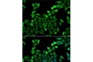 Immunofluorescence analysis of A-549 cells using TPSAB1 Polyclonal Antibody (TPSAB1 Antikörper)