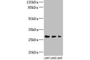 Western blot All lanes: LRRC57 antibody at 4 μg/mL Lane 1: Mouse liver tissue Lane 2: Mouse kidney tissue Lane 3: Mouse lung tissue Secondary Goat polyclonal to rabbit IgG at 1/10000 dilution Predicted band size: 27 kDa Observed band size: 27 kDa (LRRC57 Antikörper  (AA 1-239))