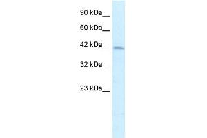 WB Suggested Anti-PAX3 Antibody Titration:  2. (Paired Box 3 Antikörper  (Middle Region))