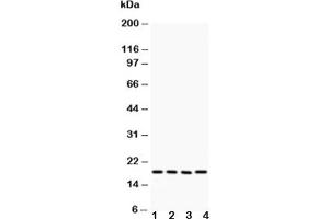 Western blot testing of Caveolin-2 antibody and Lane 1:  HeLa (Caveolin 2 Antikörper  (AA 1-162))