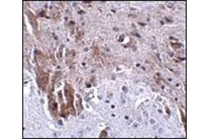 Immunohistochemistry (Paraffin-embedded Sections) (IHC (p)) image for anti-Leucine Rich Repeat and Fibronectin Type III Domain Containing 1 (LRFN1) (C-Term) antibody (ABIN500186)